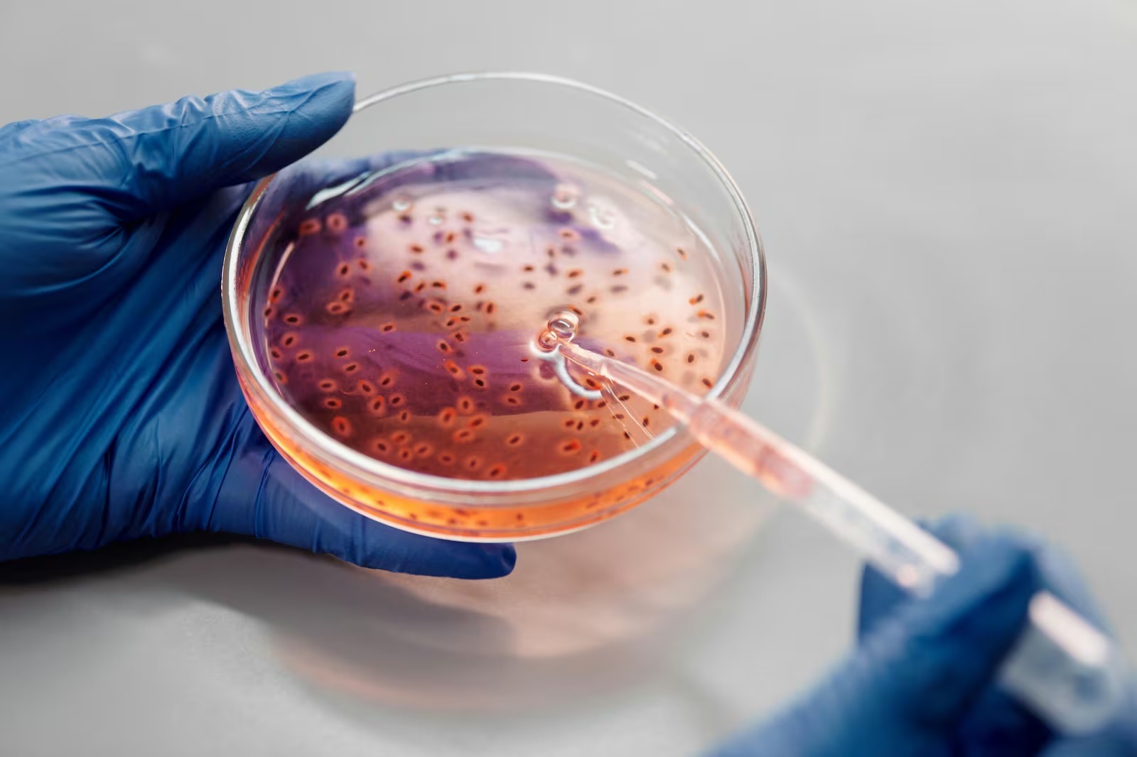 Saiba qual é o item usado diariamente que pode ser 75 vez mais sujo que vaso sanitário