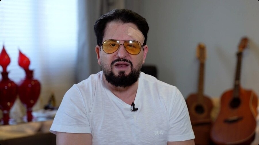 Marrone, da dupla com Bruno, fala pela 1ª vez sobre queda do palco durante show