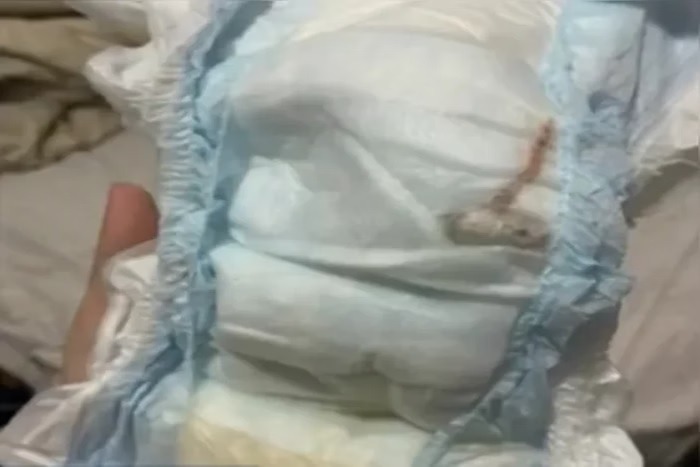 Mãe encontra animal morto dentro da fralda de bebê