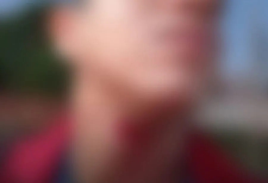 Motociclista é socorrido após ser atingido por pipa com cerol em avenida de Natal