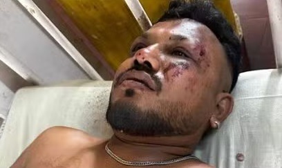 VÍDEO: Sobrevivente sai andando logo após queda de avião; assista