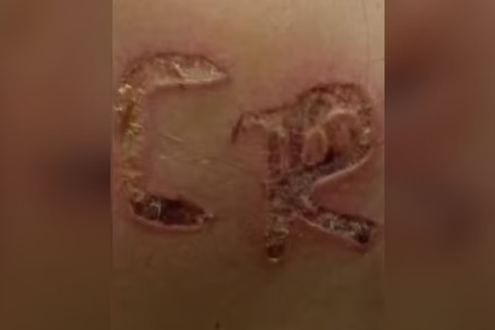 Homem marca mulher com ferro quente e a prende com corda de cachorro