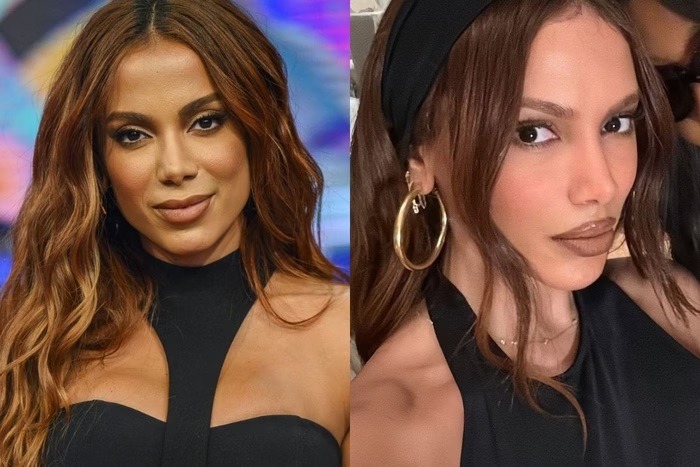 Antes e depois: veja novo rosto de Anitta em 1ª aparição após grave infecção