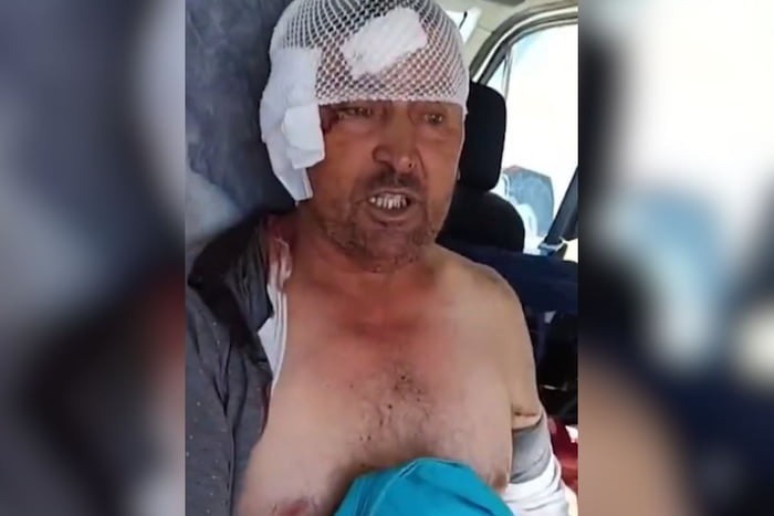 Leão foge de zoológico, ataca homem e é abatido