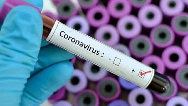 RN tem mais de 100 casos de Covid-19; suspeitos disparam a 2,1 mil
