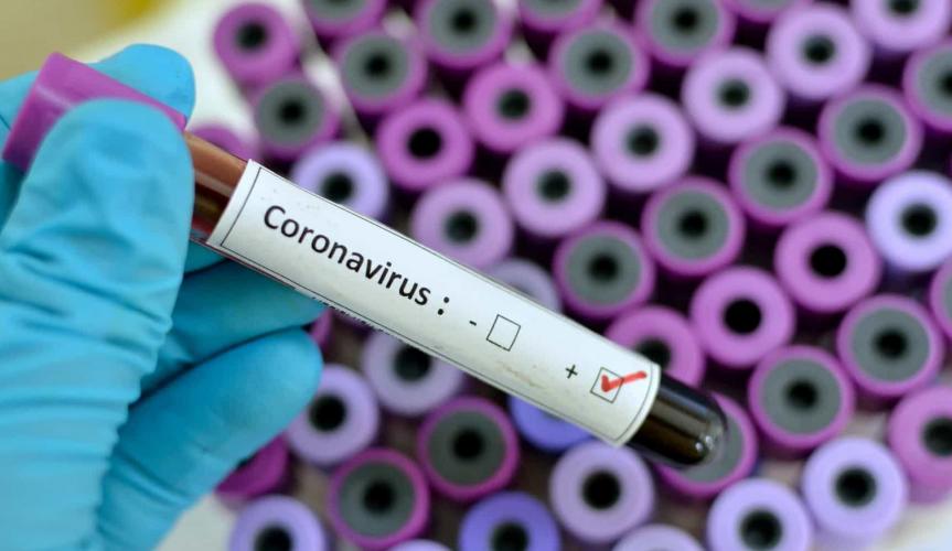 Cidade do RN registra mais duas mortes e Estado já soma 10 vítimas do Covid-19