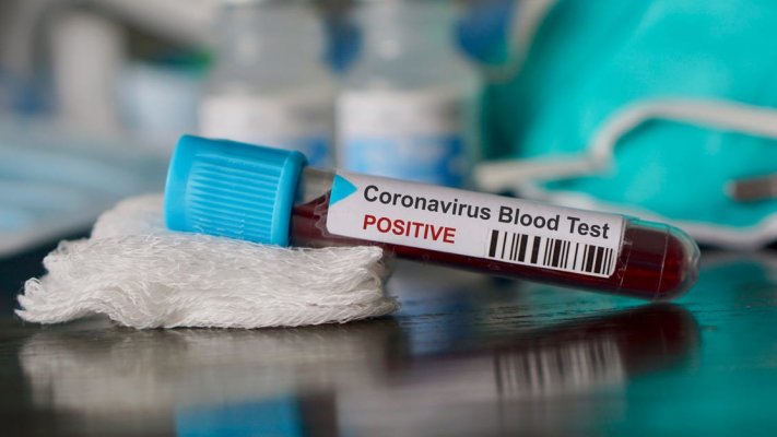 Covid: Médicos vão investigar morte de recém-nascido que testou positivo no RN