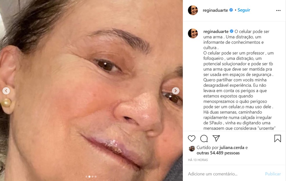Atriz consagrada cai em calçada de SP e quebra 3 dentes: 'Aterrissei de boca'