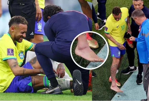 Especialista explica o que aconteceu com tornozelo de Neymar